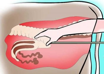 Sığırlarda Suni Tohumlama