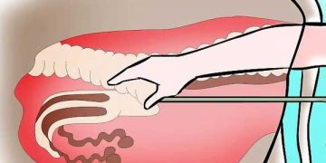 Sığırlarda Suni Tohumlama