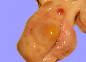 İneklerde Yumurtalık Sorunları