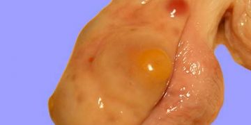 İneklerde Yumurtalık Sorunları