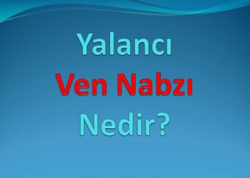 Yalancı Ven Nabzı Nedir?