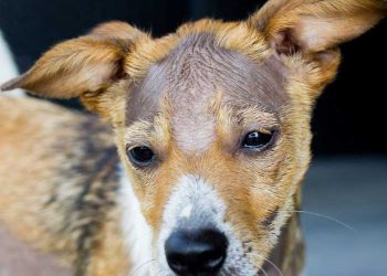 Yama Alopesisi Nedir?