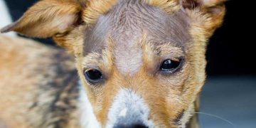 Yama Alopesisi Nedir?