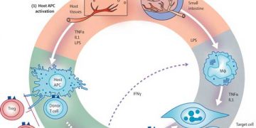 Yamaya Karşı Konak Tepkimesi Nedir?