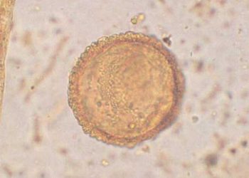 Yalancı Parazit Nedir?