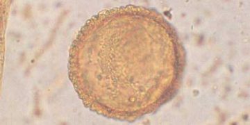 Yalancı Parazit Nedir?