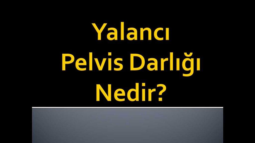 Yalancı Pelvis Darlığı Nedir?