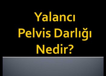 Yalancı Pelvis Darlığı Nedir?