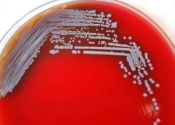 Yalancı Ruam Nedir?