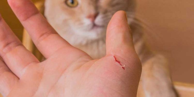 Kedi Tırmalama Hastalığı (Cat Scratch Disease - CSD)