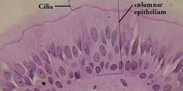 Yalancı Çok Katlı Prizmatik Epitel Nedir?