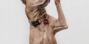 Yalancı Felç Nedir?