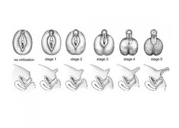 Yalancı Hermafrodizm Nedir?