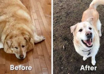 Yalancı Hipertrofi Nedir?