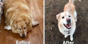 Yalancı Hipertrofi Nedir?