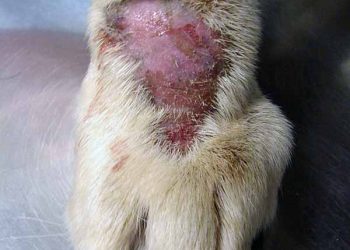 Yalama Granülomu Nedir?