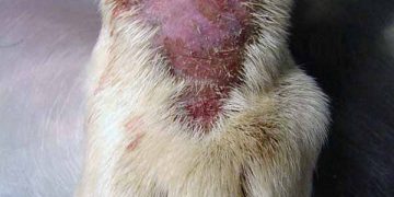 Yalama Granülomu Nedir?