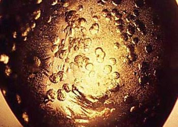 Yağların Kristalleştirilmesi Nedir?