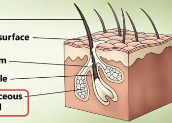 Yağ Bezi Kisti Nedir?