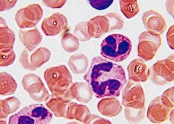 Wright Boyası Nedir?