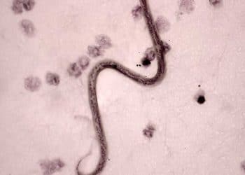 Wuchereria Bancrofti Nedir?