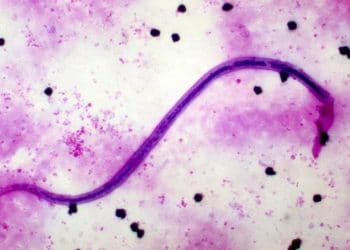 Wuchereria Malayi Nedir?