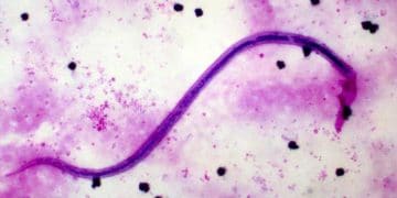 Wuchereria Malayi Nedir?