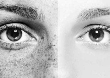 Yaşlılığı Nasıl Geciktirebiliriz?