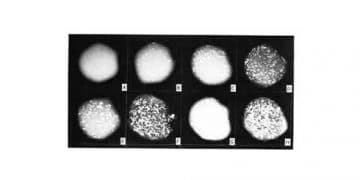 Whiteside Testi Nedir?