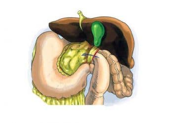 Winslowi Fıtkı Nedir?