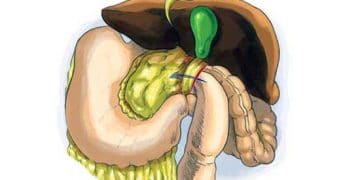 Winslowi Fıtkı Nedir?