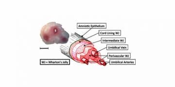 Wharton Peltesi Nedir?