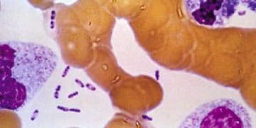 Wayson Boyama Yöntemi Nedir?