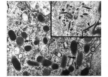 Weibel Palade Cisimciği Nedir?