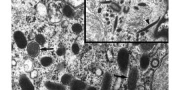 Weibel Palade Cisimciği Nedir?