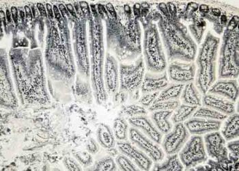 Weigert Demir Hematoksilen Boyası Nedir?