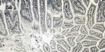 Weigert Demir Hematoksilen Boyası Nedir?