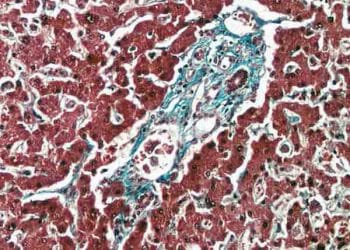 Weigert Fibrin Boyama Yöntemi Nedir?