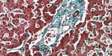 Weigert Fibrin Boyama Yöntemi Nedir?