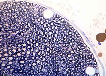 Weigert Miyelin Kılıf Boyası Nedir?