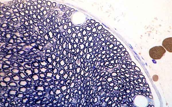 Weigert Miyelin Kılıf Boyası Nedir?