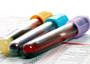 Weil Hastalığı Nedir?