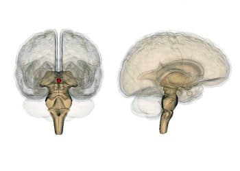 Wernicke Korsakoff Sendromu Nedir?