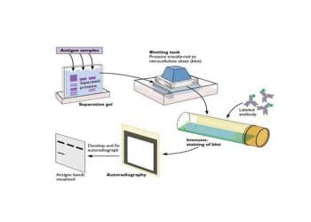 Western Blot Analizi Nedir?