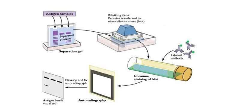 Western Blot Analizi Nedir?