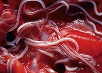 BRD Paraziter Pnömoni (Verminöz Pnömoni)