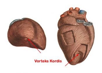 Vorteks Kordis Nedir?