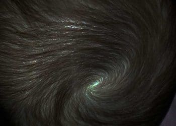 Vorteks Pilorum Nedir?