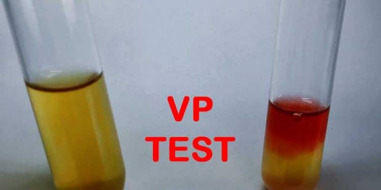 VP Testi Nedir?