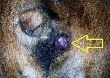 Vulva Tümörleri Nedir?